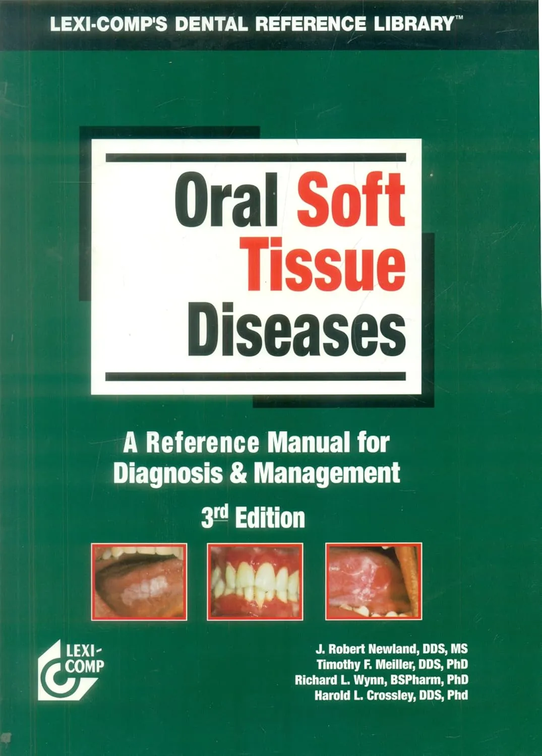 Oral Soft Tissue Diseases A Reference Manual for Diagnosis and Management | Third Edition | Paperback