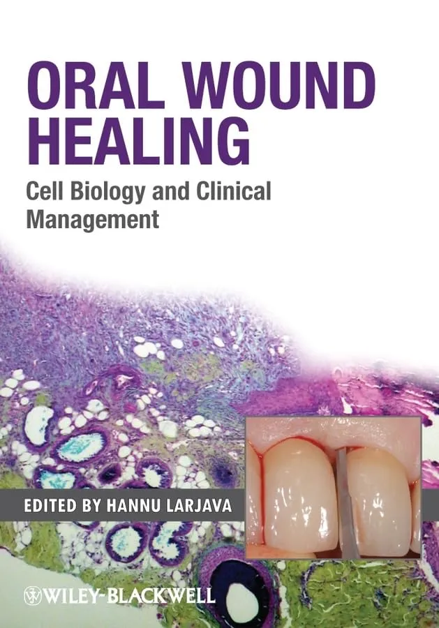 Oral Wound Healing Cell Biology and Clinical Management | Hardcover