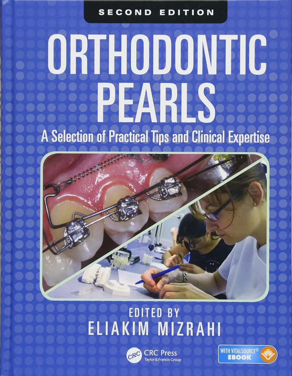 Orthodontic Pearls | 2nd Edition | Hardcover