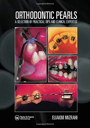 Orthodontic Pearls A Selection Of Practical Tips And Clinical Expertise | Hardcover