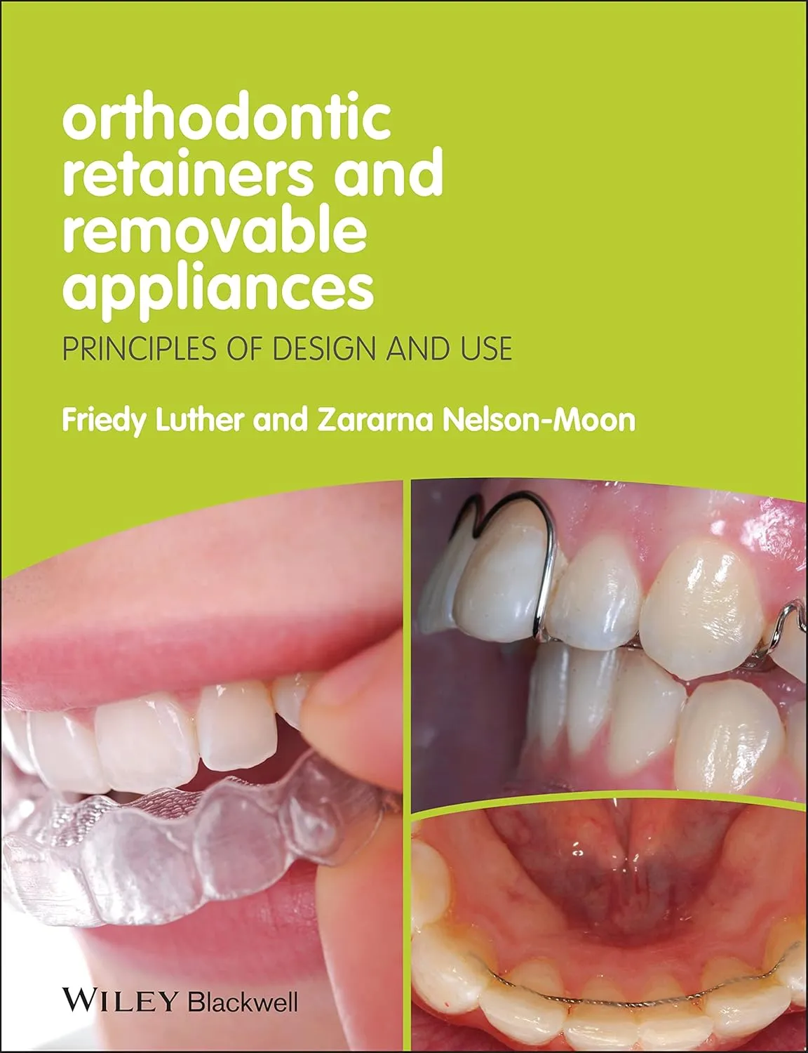 Orthodontic Retainers and Remvable Appliances Principles of Design and Use | Paperback