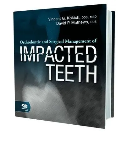Orthodontic and Surgical Management of Kmpacted Teeth | Paperback
