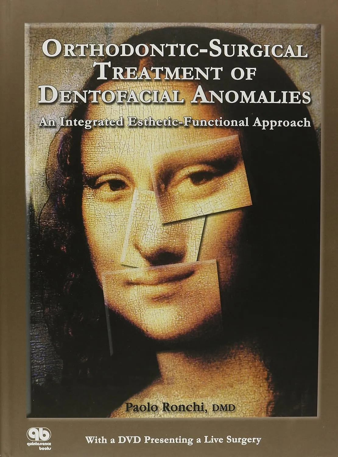 Orthodontic-Surgical Treatment of Dentofacial Anomalies An Integrated Esthetic-Functional Approach | Hardcover