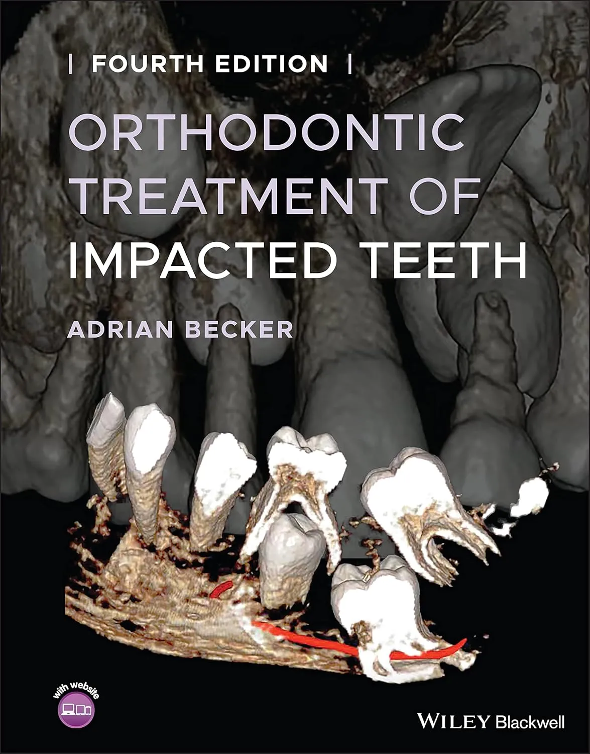 Orthodontic Treatment Of Impacted Teeth 4th Edition | Hardcover