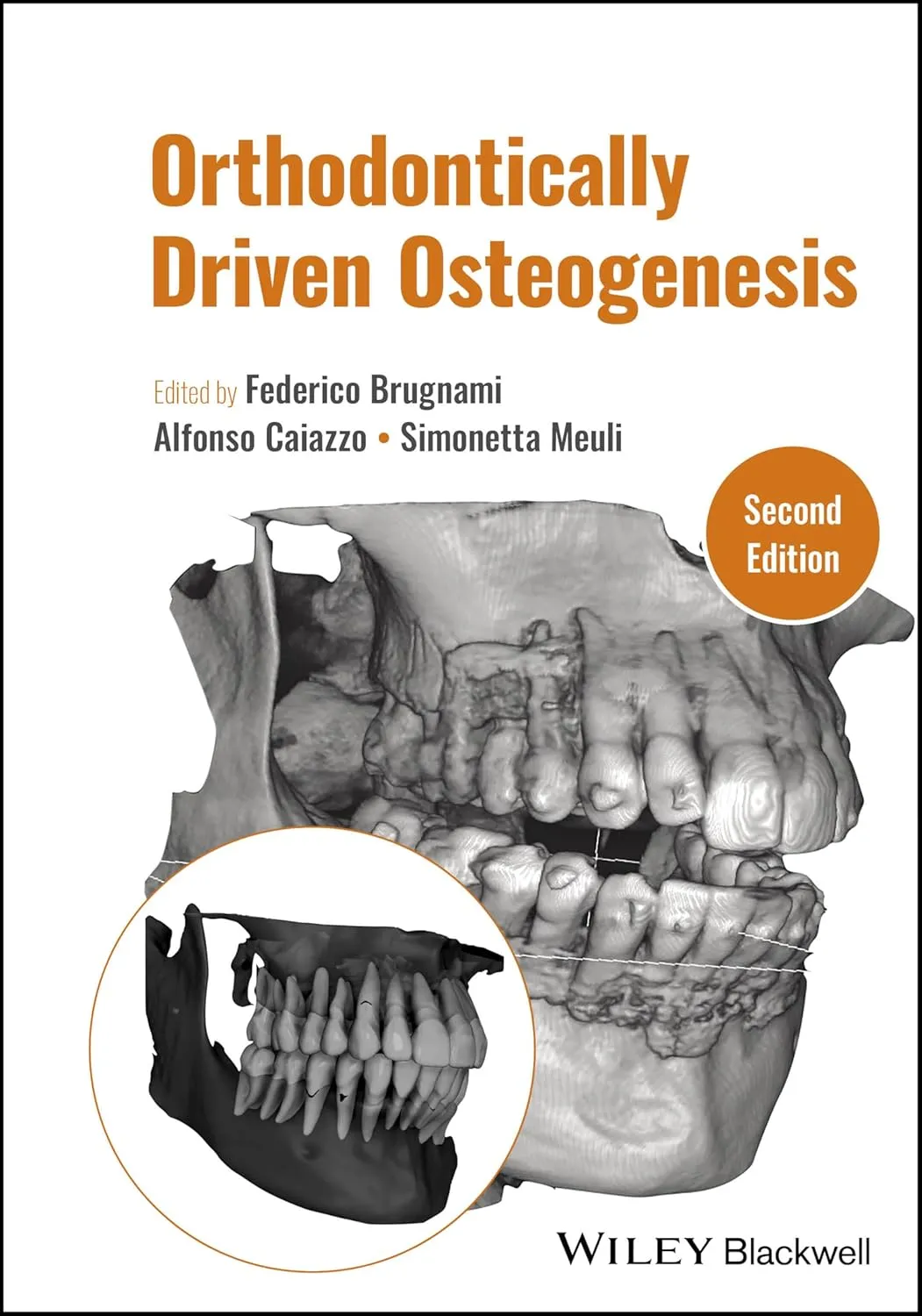 Orthodontically Driven Osteogenesis 2nd Editiond | Hardcover
