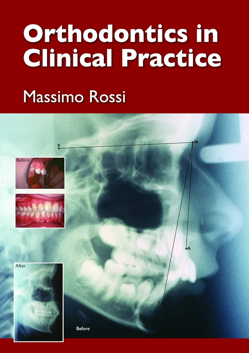 Orthodontics in Clinical Paractice | Hardcover