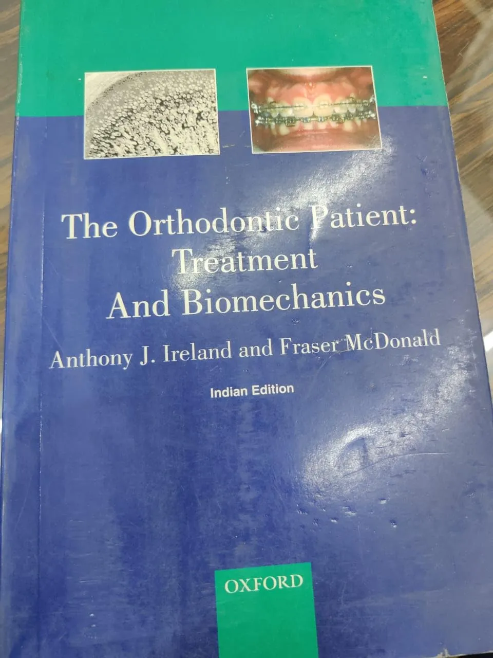 The Orthodontics Patient Treatment and Biomechanics