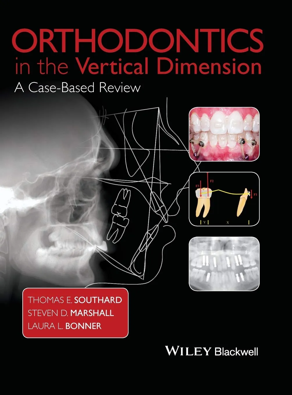 Orthodontics in the Vertical Dimension A Case-Based Review | Hardcover