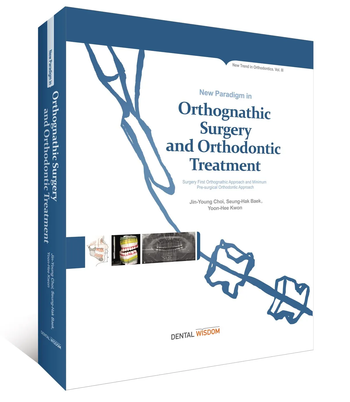 Orthognathic Surgery and Orthodontic Treatment | Hardcover