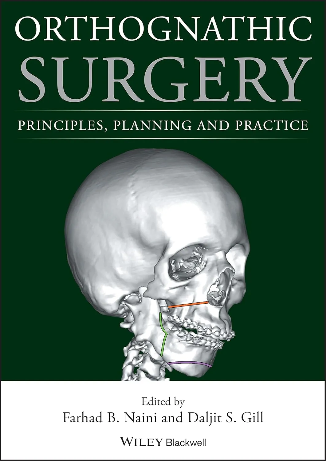Orthognathic Surgery Principles | Planning and Practice | Hardcover