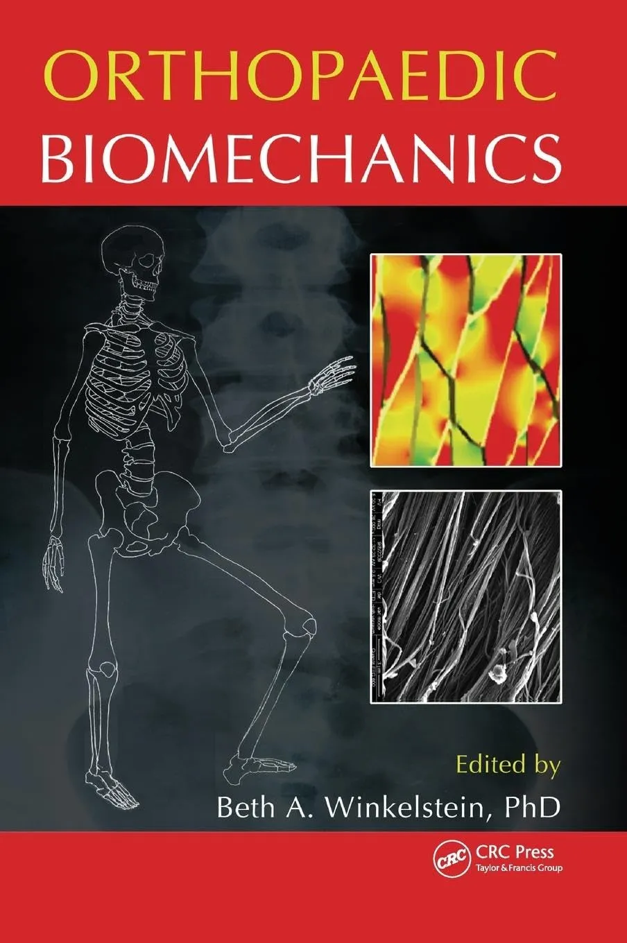 Orthopaedic Biomechanics | Hardcover