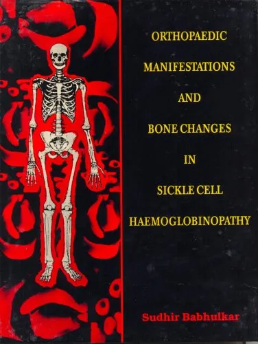 Orthopaedic Manifestations and Bone Changes in Sickle Cell Haemoglobinopathy