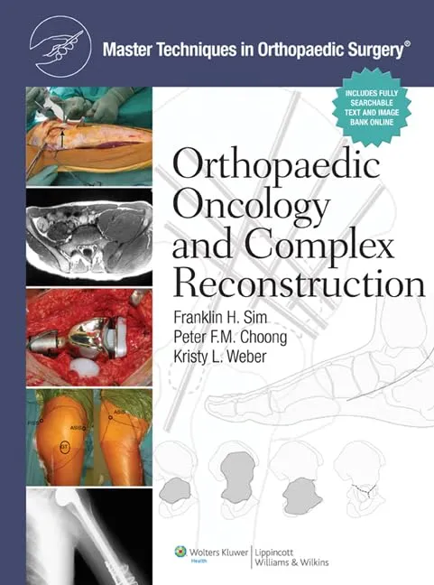 Orthopaedic Oncology and Complex Reconstruction Master Techniques in Orthopaedic Surgery | Hardcover