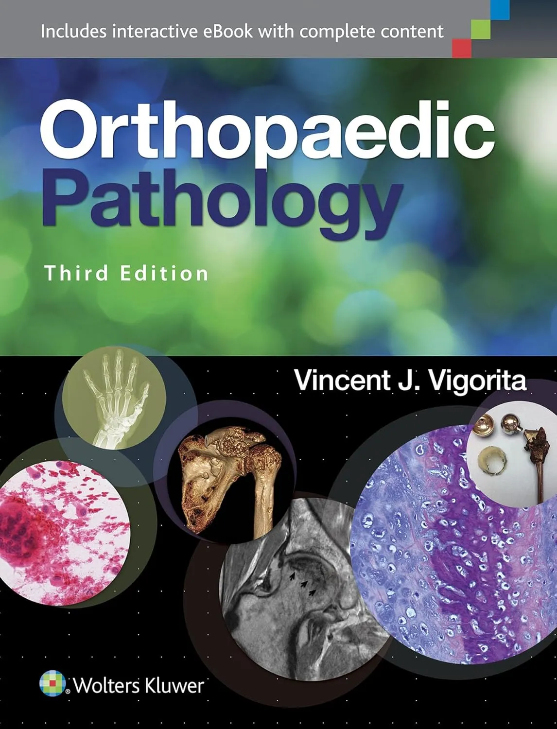 Orthopaedic Pathology | Third Edition | Hardcover