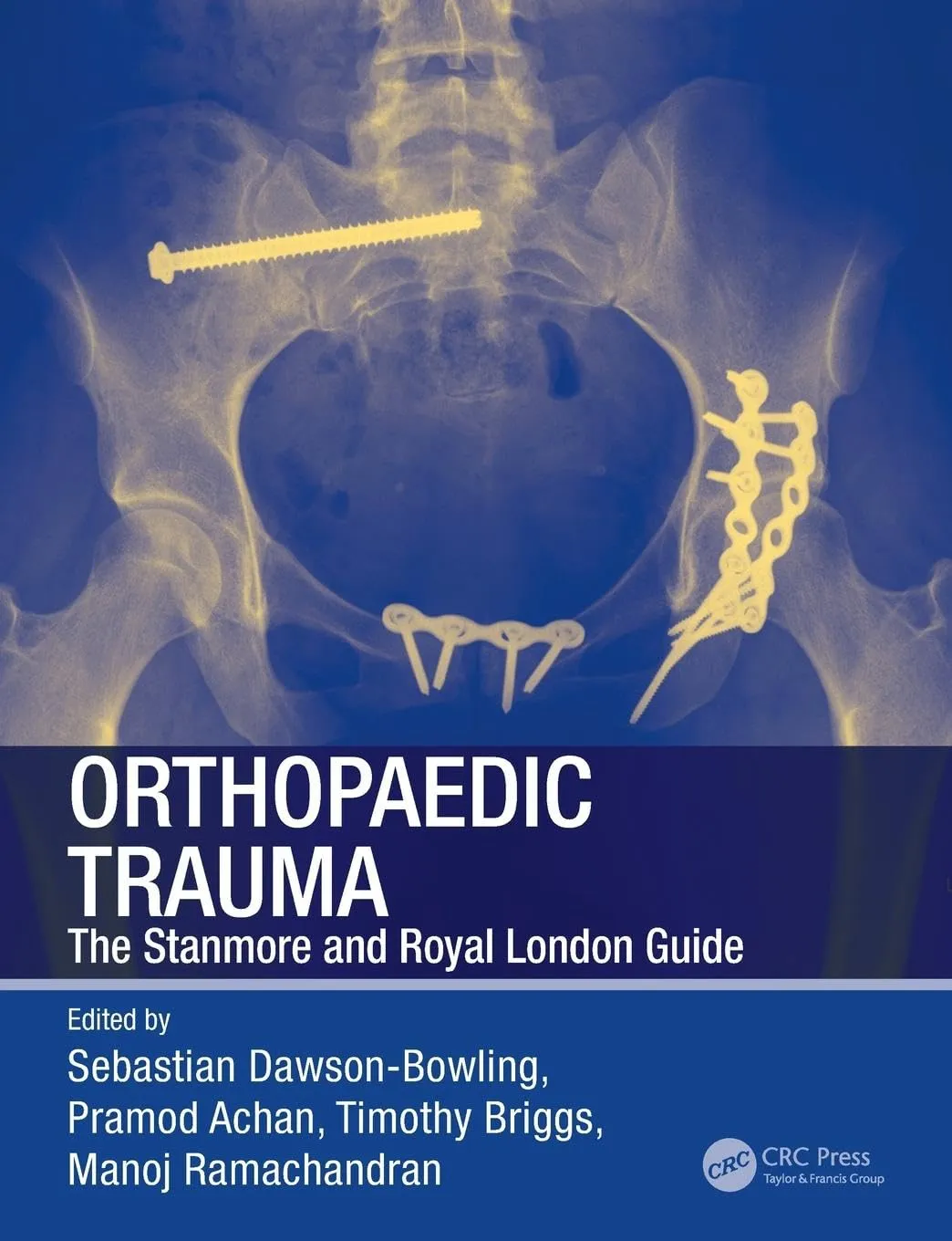 Orthopaedic Trauma The Stanmore and Royal London Guide | Paperback