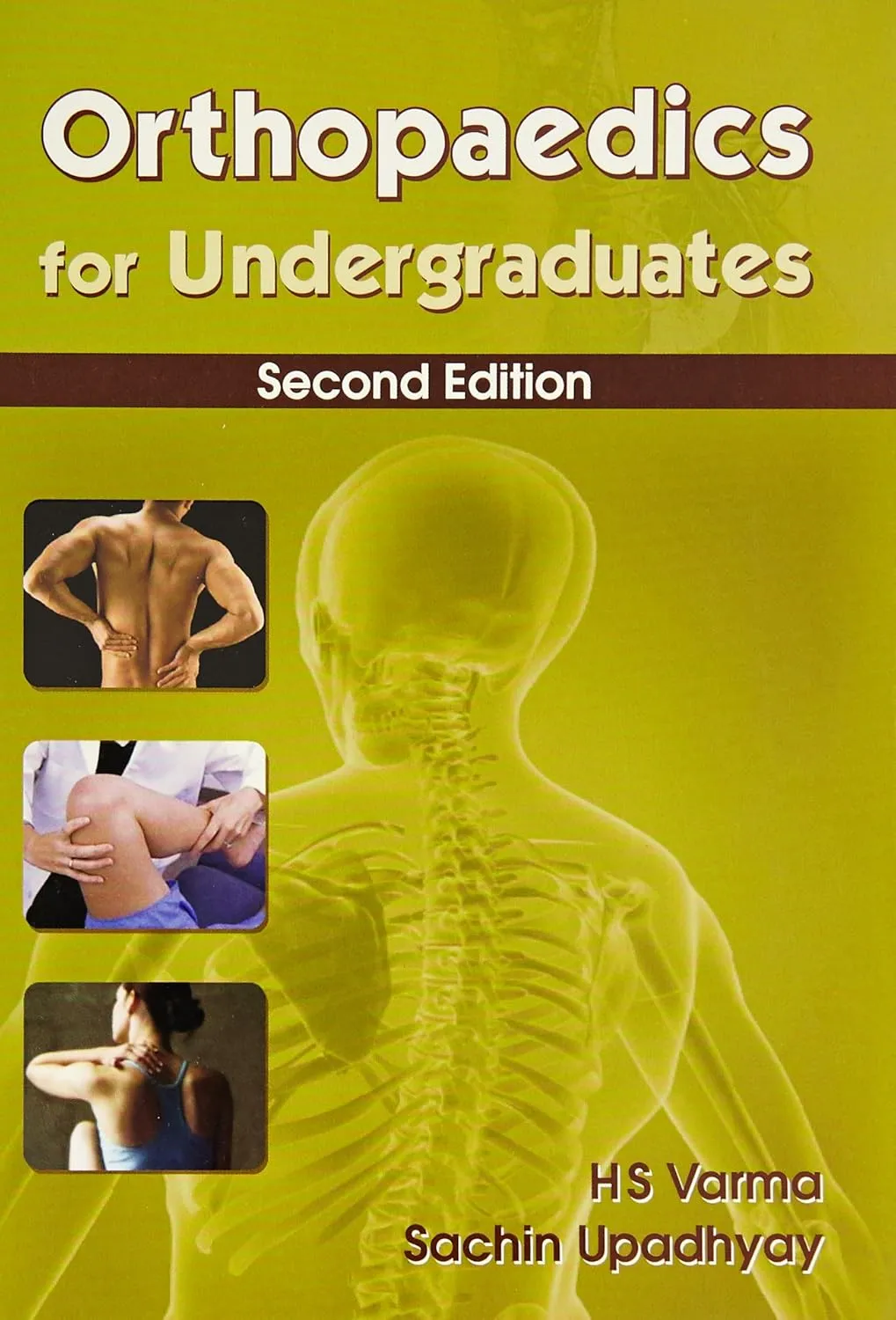 Orthopaedics for Undergraduates | 2nd Edition