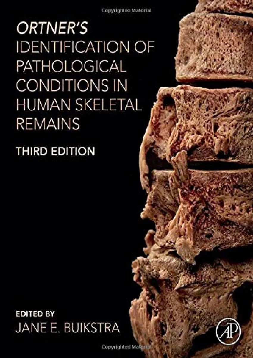 Ortners Identification Of Pathological Conditions In Human Skeletal Remains Third Edition | Hardcover