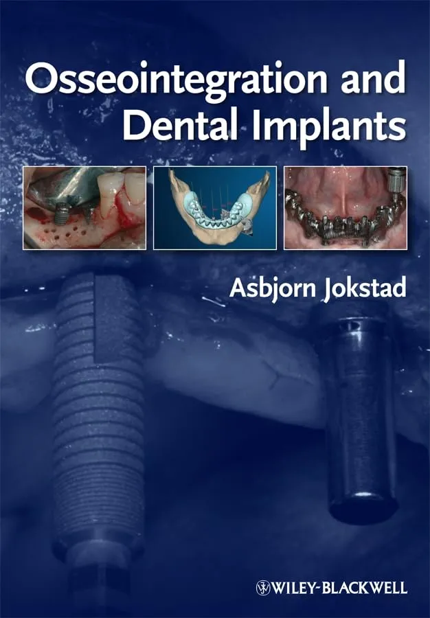 Osseointegration and Dental Implants | Hardcover
