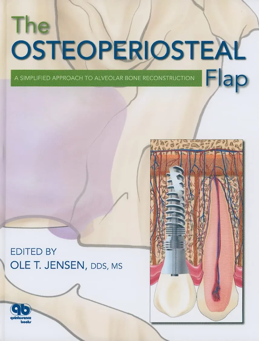 The Osteoperiosteal Flap A Simplified Approach to Alveolar Bone Reconstruction | Hardcover