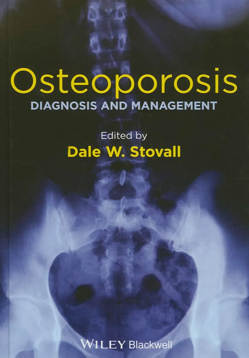 Osteoporosis Diagnosis and Management | Hardcover
