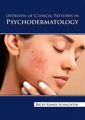 Overview Of Clinical Patterns In Psychodermatology | Hardcover