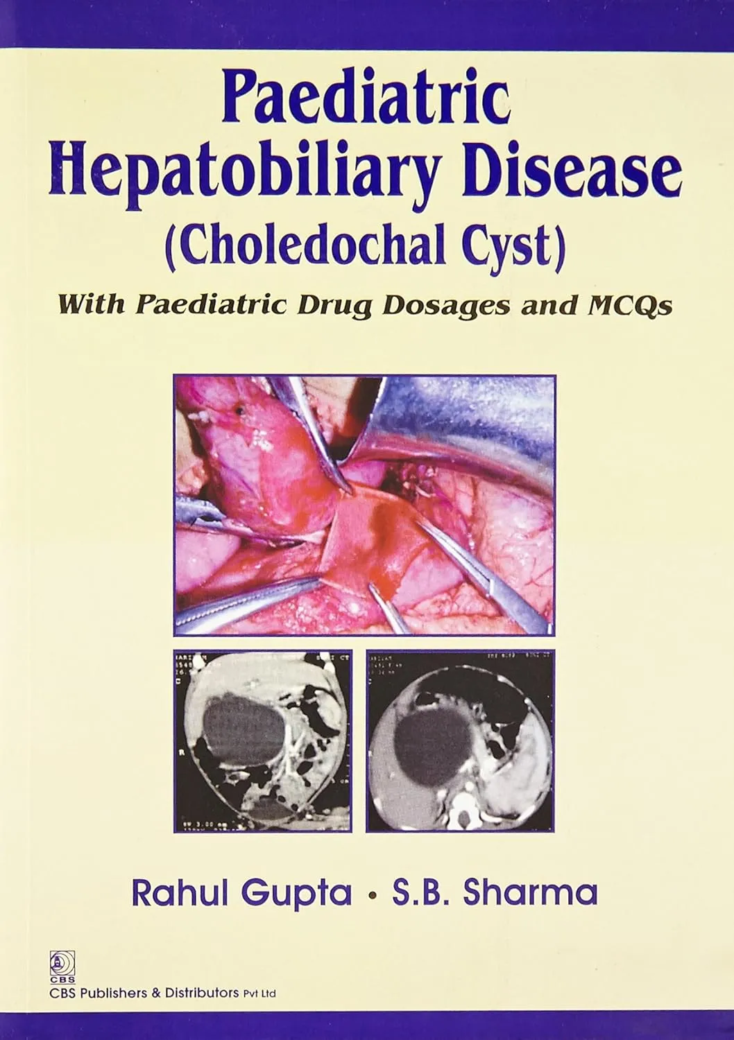 Paediatric Hepatobiliary Disease (Choledochal Cyst) With Paediatric Drug Dosages and MCQS | Paperback