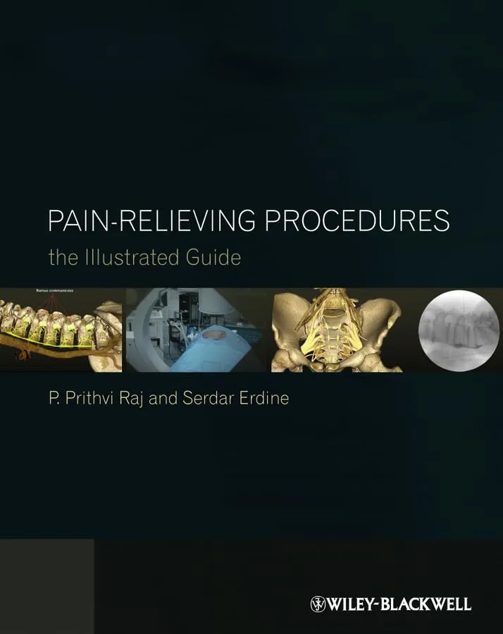 Pain-Relieving Procedures The Illustrated Guide | Hardcover