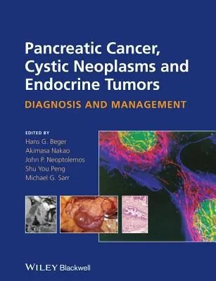 Pancreatic Cancer | Cystic Neoplasms | and Endocrine Tumors Diagnosis and Management | Hardcover