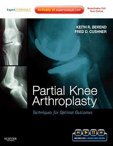 Partial Knee Arthroplasty Techniques for Optimal Outcomes | Hardcover