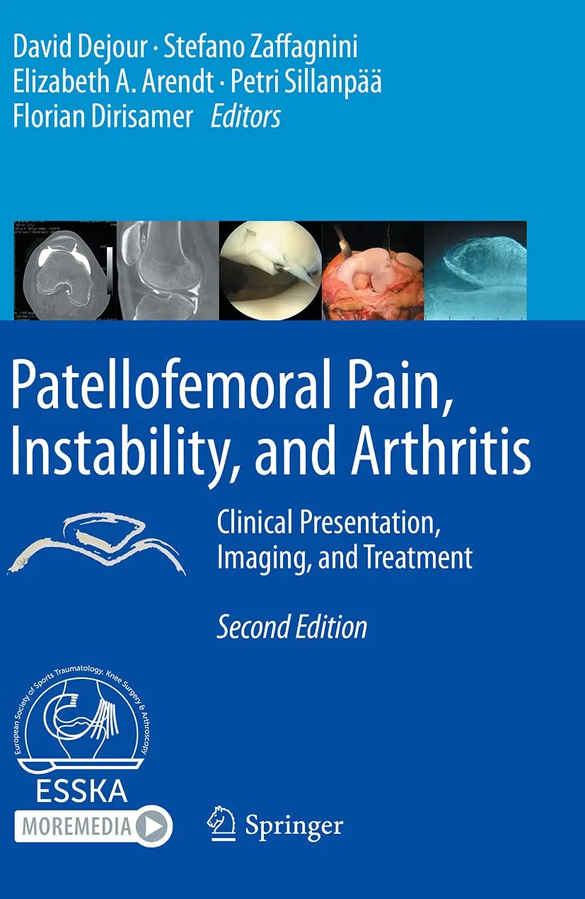 Patellofemoral Pain Instability And Arthritis Clinical Presentation Imaging And Treatment 2nd Edition | Paperback