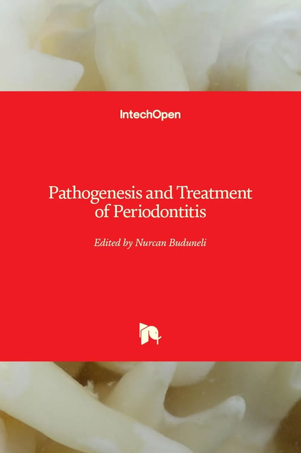 Pathogenesis and Treatment of Periodontitis | Hardcover