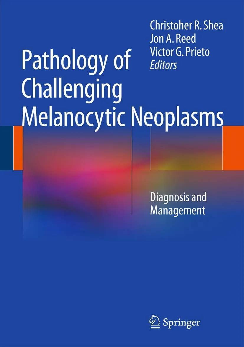 Pathology of Challenging Melanocytic Neoplasms | Hardcover