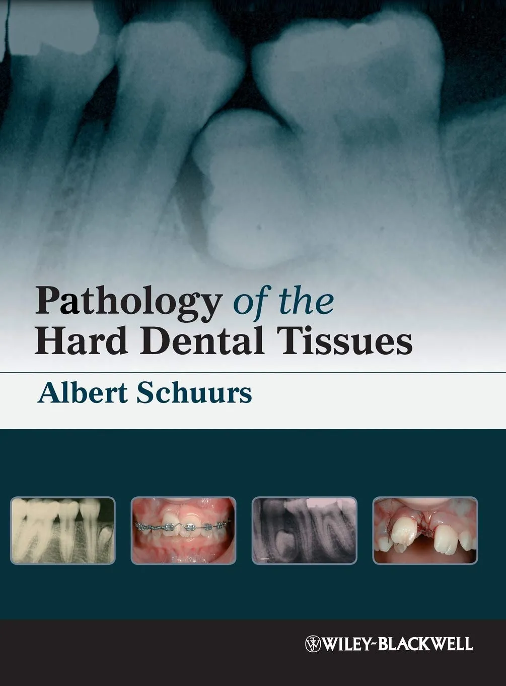 Pathology of the Hard Dental Tissues | Hardcover