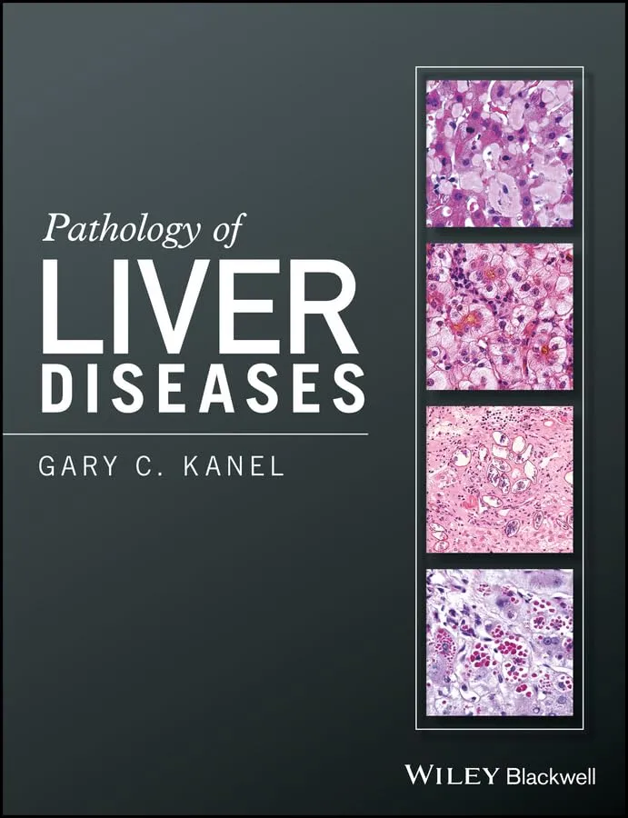 Pathology of Liver Diseases | Hardcover