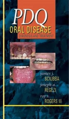 PDQ Oral Disease Diagnosis and Treatment With CD | Paperback