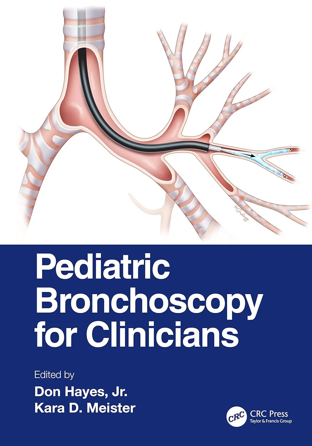 Pediatric Bronchoscopy For Clinicians | Paperback