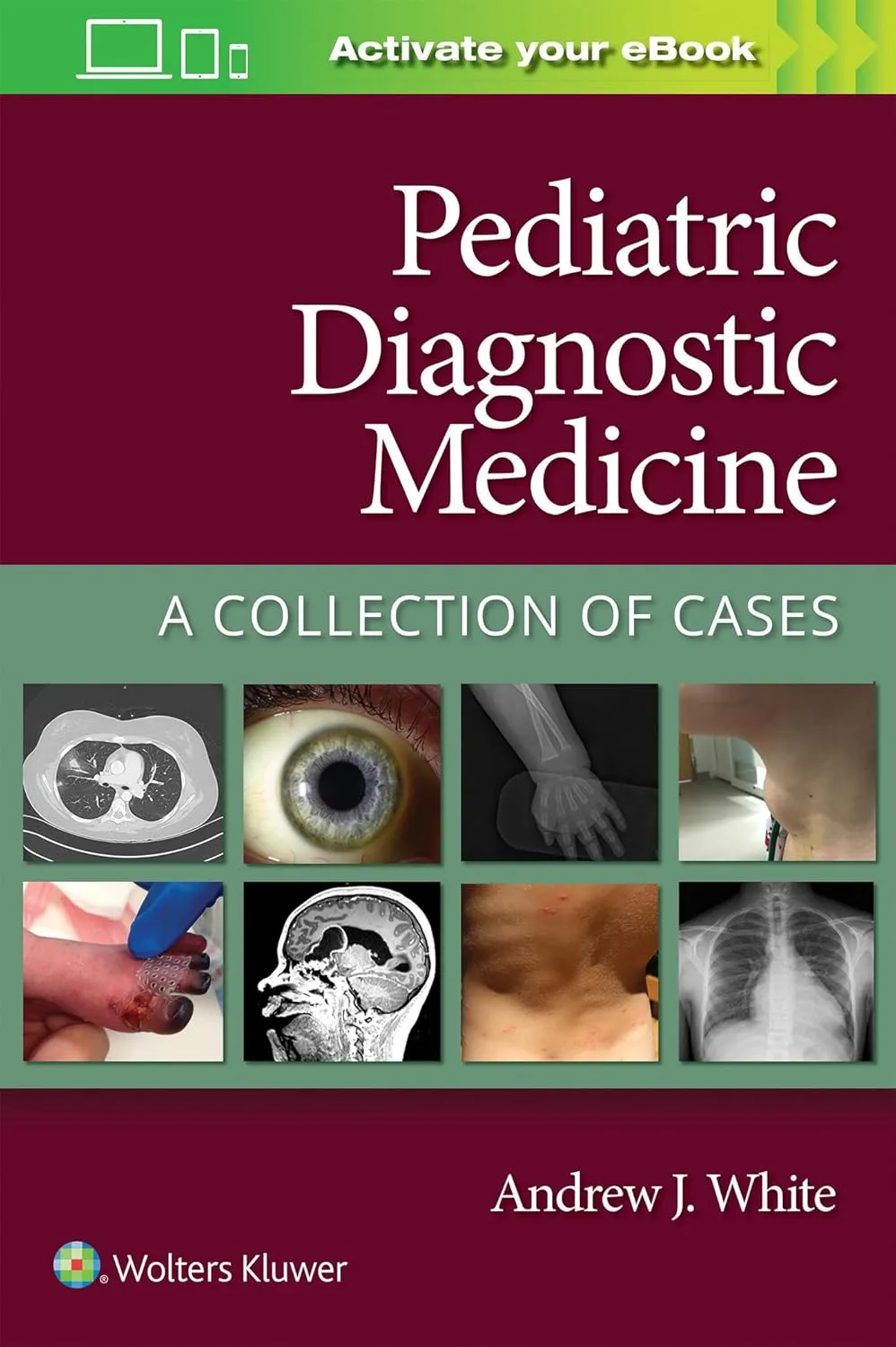 Pediatric Diagnostic Medicine A Collection Of Cases | Paperback