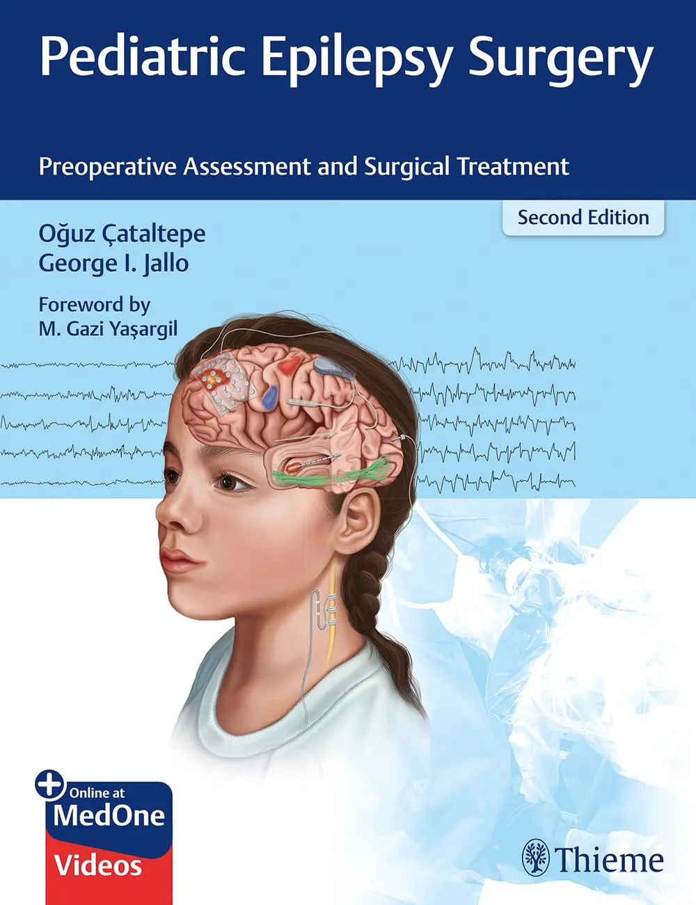 Pediatric Epilepsy Surgery Preoperative Assessment and Surgical Treatment | 2nd Edition | Hardcover