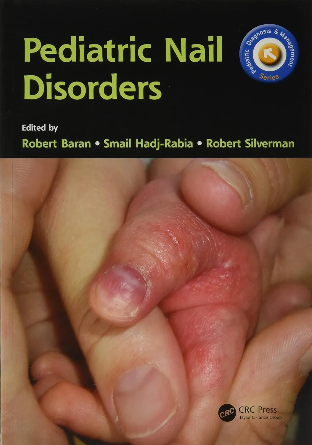 Pediatric Nail Disorers | Paperback
