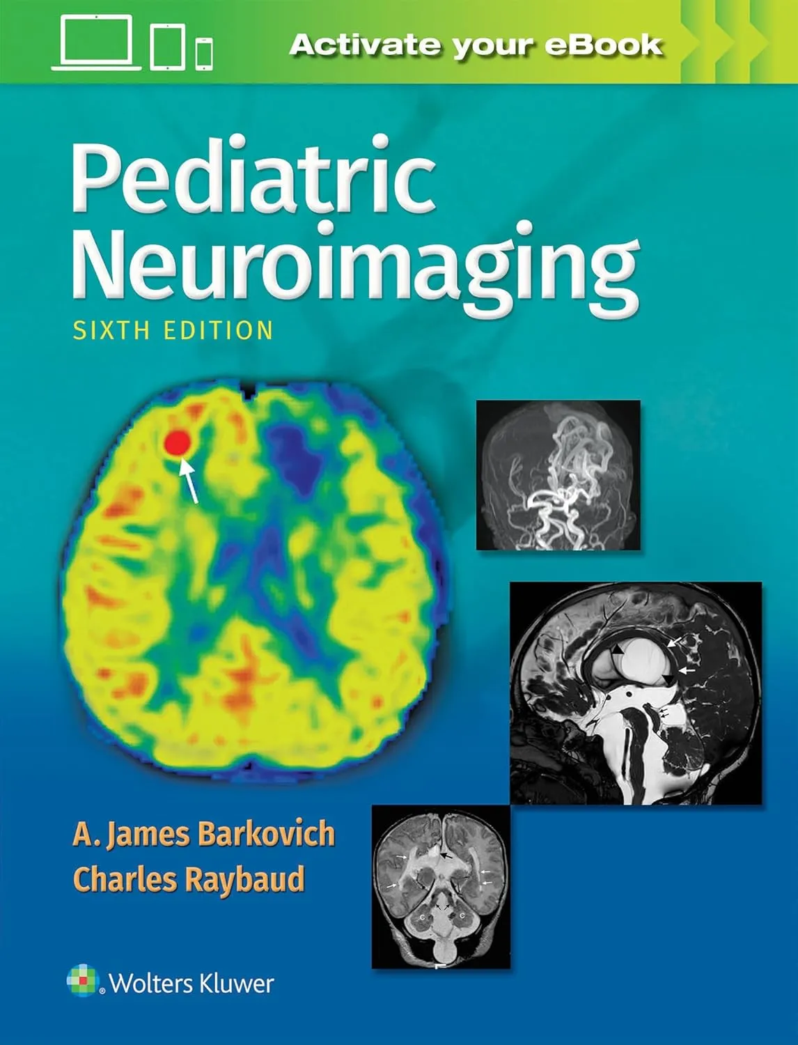 Pediatric Neuroimaging | 6th Edition | Hardcover