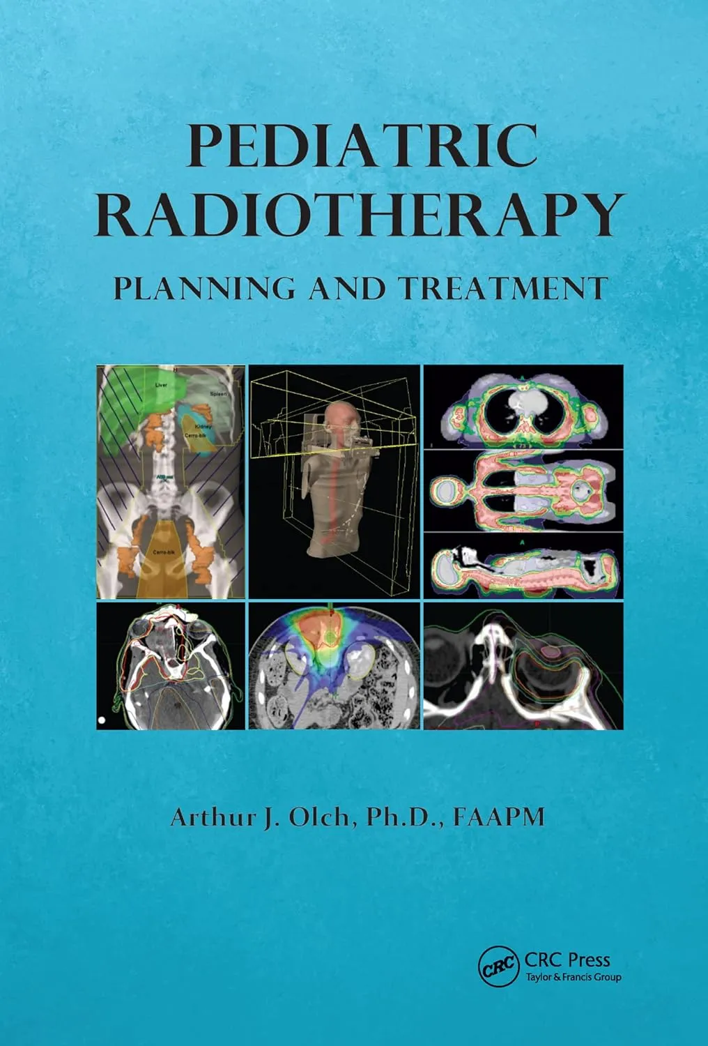 Pediatric Radiotherapy Planning and Treatment | Hardcover