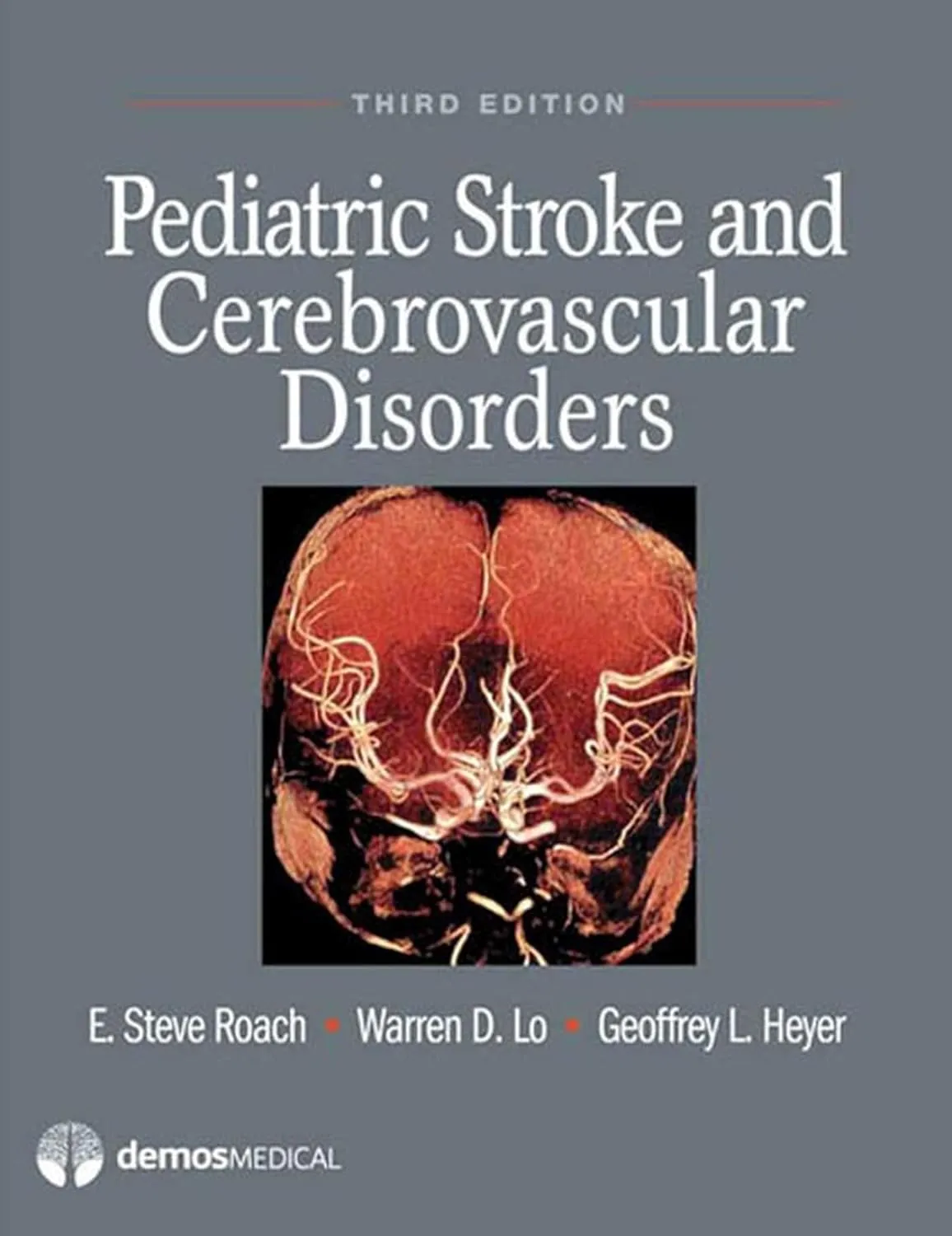Pediatric Stroke and Cerebrovascular Disorders | Third Edition | Hardcover