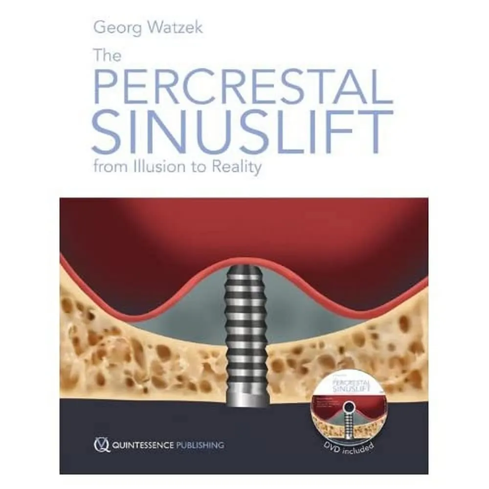 The Percrestal Sinuslift From Illusion to Reality | Hardcover