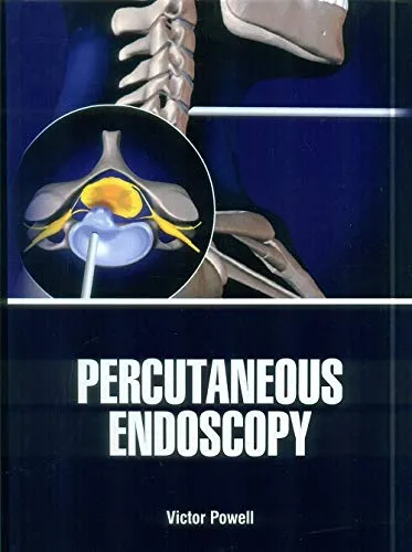 Percutaneous Endoscopy | Hardcover