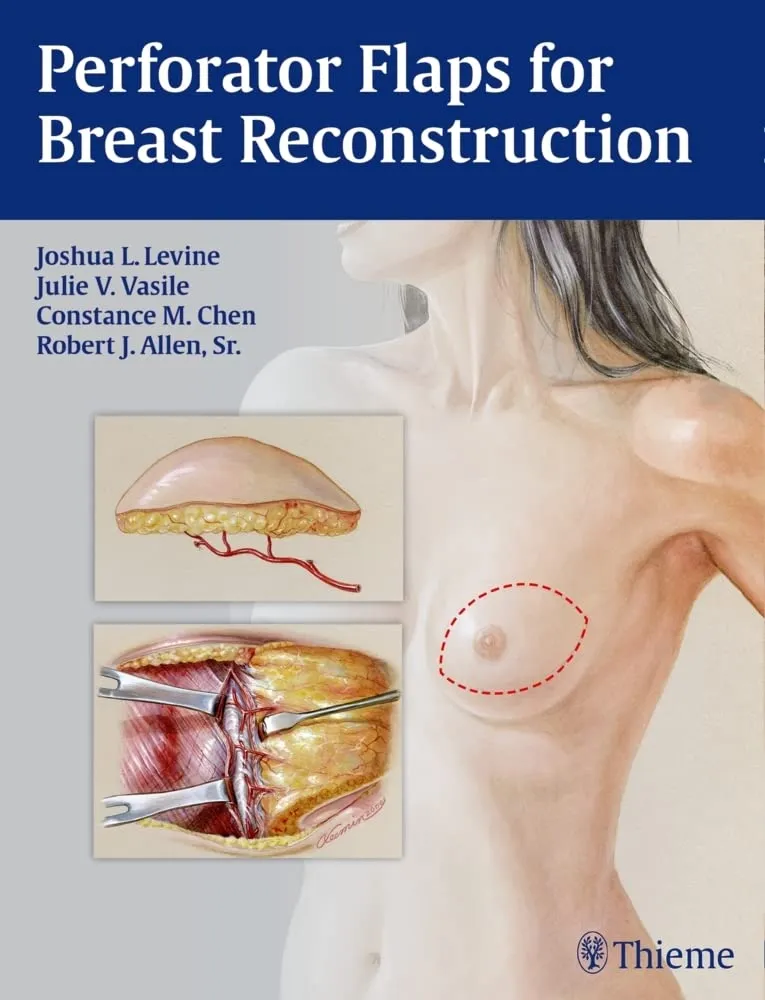 Perforator Flaps for Breast Reconstruction | Hardcover