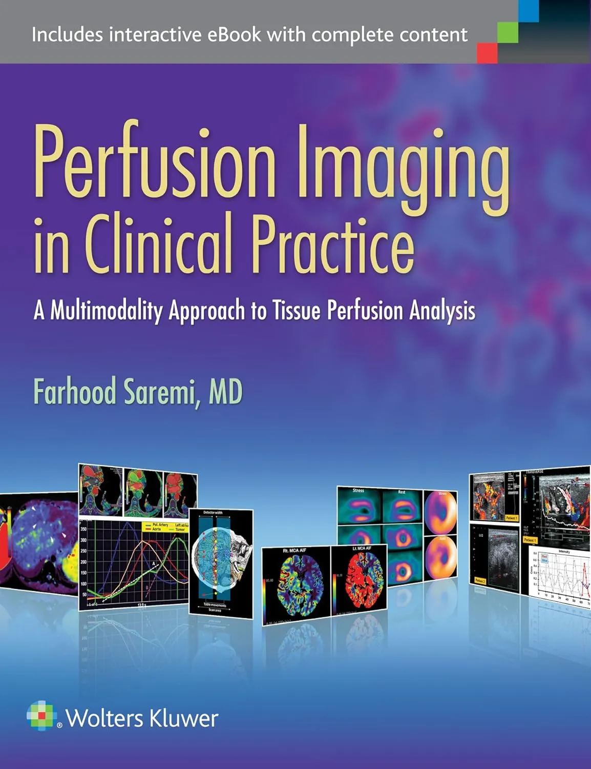 Perfusion Imaging in Clinical Practice | Hardcover