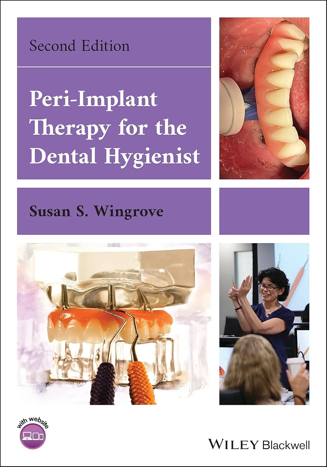 Peri Implant Therapy For The Dental Hygienist 2nd Edition | Paperback