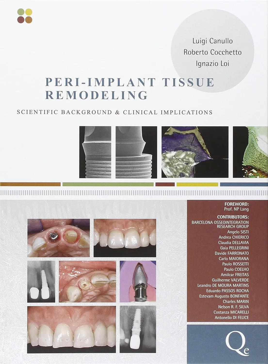 Peri-Implant Tissue Remodeling Scientific Background and Clinical Implications | Hardcover