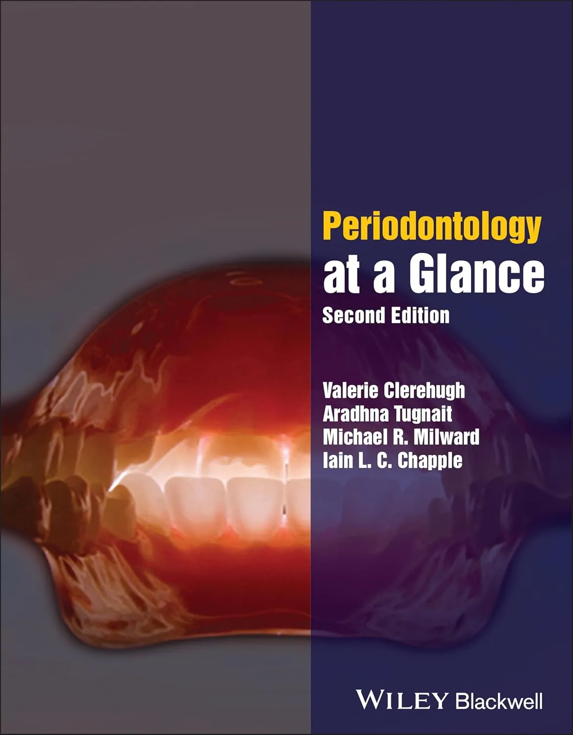 Periodontology At A Glance 2nd Editiond | Paperback