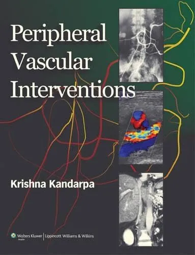 Peripheral Vascular Interventions | Hardcover